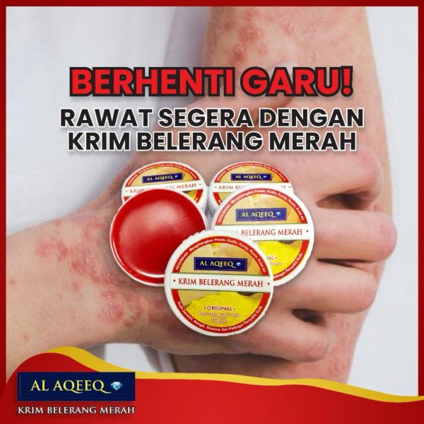 KRIM BELERANG MERAH AL AQEEQ - Image 7