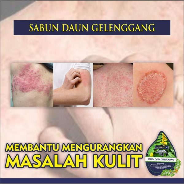 AL-AQEEQ SABUN DAUN GELENGGANG (RAWAT GATAL, JERAWAT, RESDUNG,PANAU, KUDIS) 60GM - Image 4